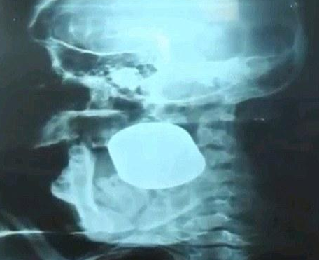 Meksika mucize kadını konuşuyor - Resim: 1