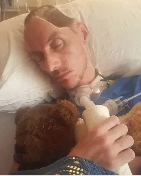 Beyzbol sopalı saldırı hayatını kararttı! Kafasının yarısı alındı - Resim: 3