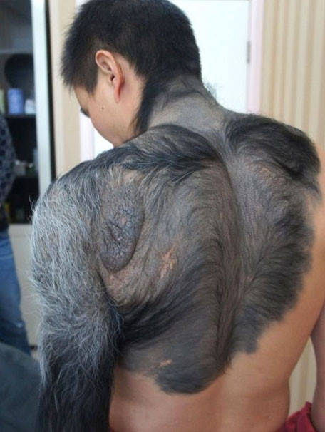 Vücudu görenleri dehşete düşürdü - Resim: 3