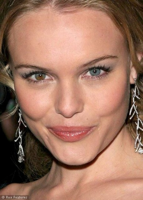 Ünlülerin de kusurları var - Resim: 2