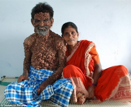 Hastalığı hayatını mahvetti - Resim: 1