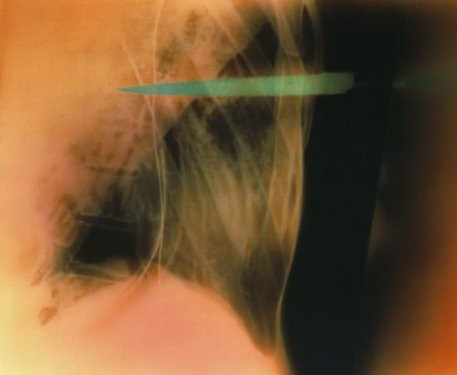 Dünyanın en ilginç röntgenleri! - Resim: 1