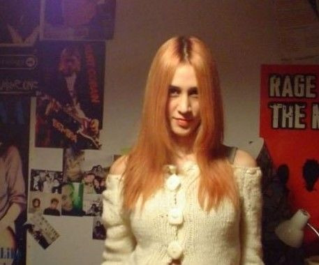 Çok Güzel Hareketler Bunlar'ın Zeynep'inin son halini görenler tanıyamadı! Böyle bir estetik olamaz! - Resim: 2