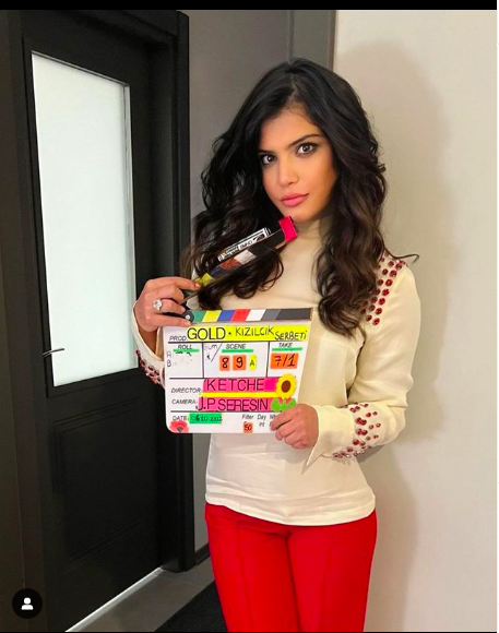 Kızılcık Şerbeti Nilay neden sacını göstermiyor peruk takıyor sebebi ilginç - Resim: 1