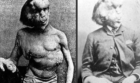 Bu kadının dört bacağı var - Resim: 4