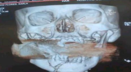 Meksika mucize kadını konuşuyor - Resim: 2