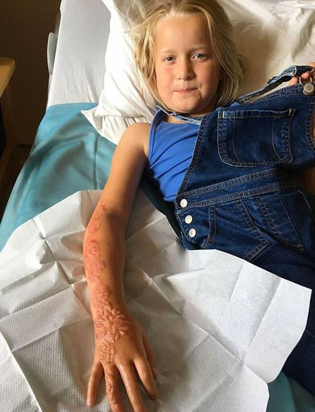 Küçük kızın kolu bu hale geldi hayatı zehir oldu bakın neden - Resim: 3