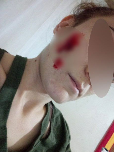 Adana'da son dakikalarını yaşıyordu uygulamayı indirdi hayatı kurtuldu - Resim: 4