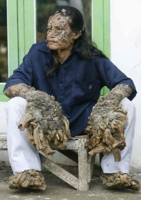 Ağaç adamın son hali - Resim: 3