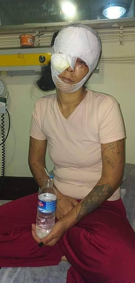 Gaziantep'te sevgili dehşeti! Metruk binaya kapatıp 7 saat işkenceyle tecavüz etti - Resim: 4