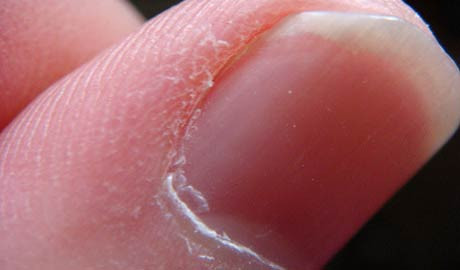 Hayatınızı kurtaracak 16 ipucu! - Resim: 2