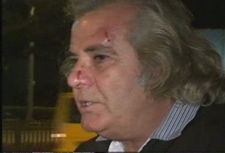 Tarık Akan'ı copla dövdüler! - Resim: 1