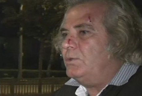 Tarık Akan'ı copla dövdüler! - Resim: 2