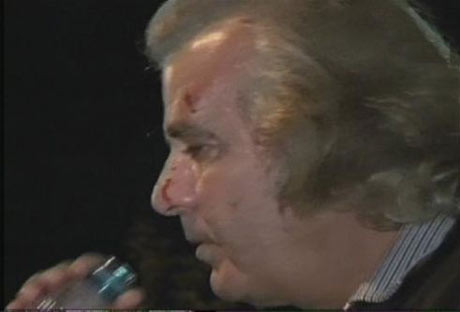 Tarık Akan'ı copla dövdüler! - Resim: 3