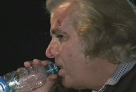 Tarık Akan'ı copla dövdüler! - Resim: 4