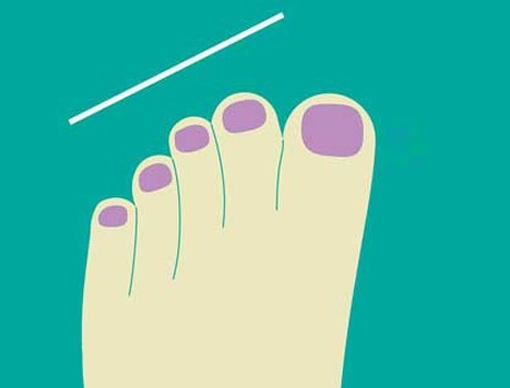 Ayak parmaklarından karakter analizi - Resim: 3