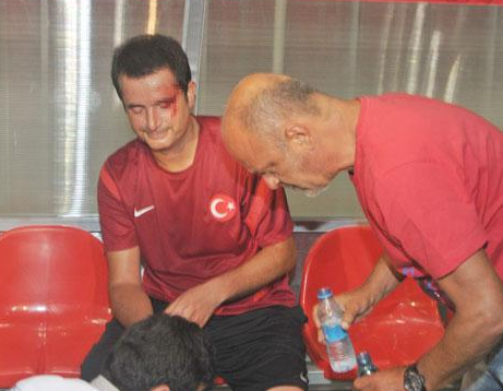 Acun Ilıcalı'nın kaşı yarıldı - Resim: 1