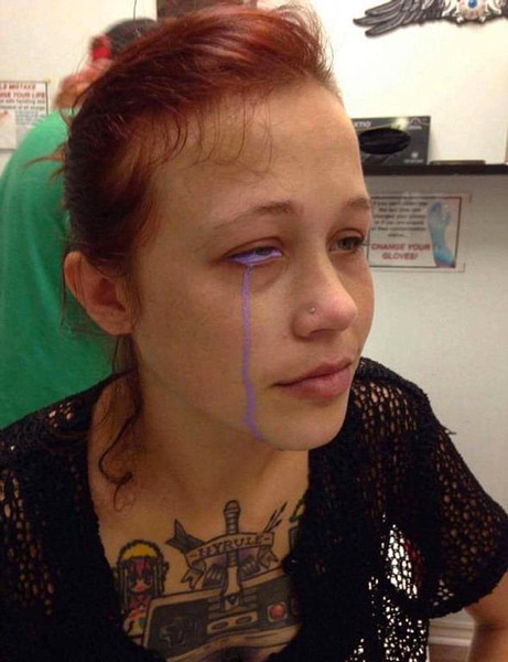 Gözü bir anda bu hale geldi doktorlar hayrete düştü - Resim: 4