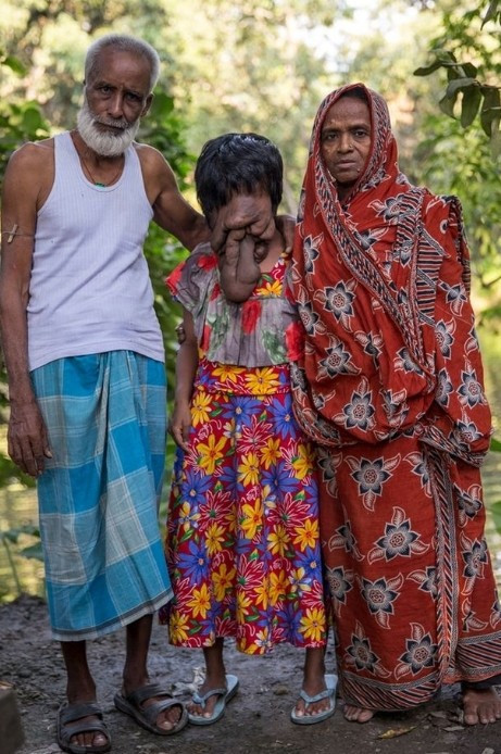 Genç kızın yüzüne bakan donup kalıyor - Resim: 3