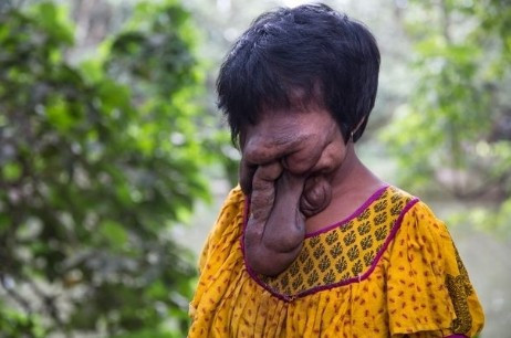 Genç kızın yüzüne bakan donup kalıyor - Resim: 2