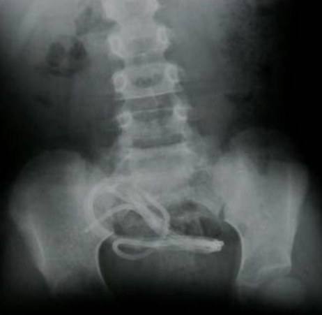 Bu ölümler Türkler'e özgü... - Resim: 3