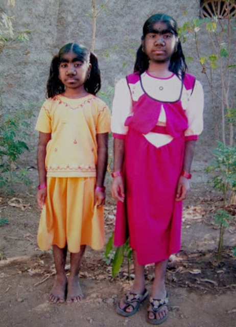 Kurt alienin yeni üyesi doğdu - Resim: 2