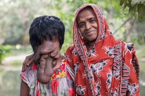 Genç kızın yüzüne bakan donup kalıyor - Resim: 4