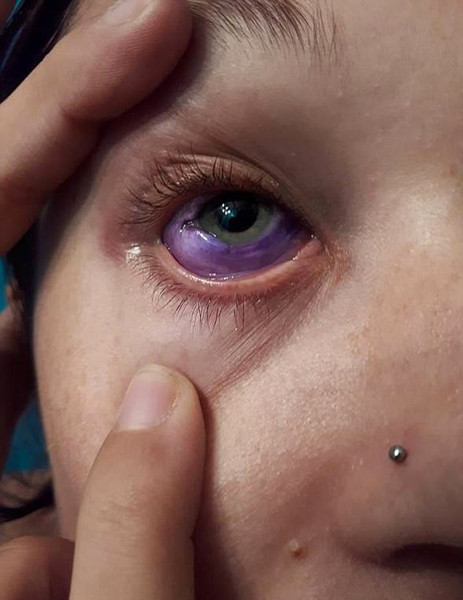 Gözü bir anda bu hale geldi doktorlar hayrete düştü - Resim: 3