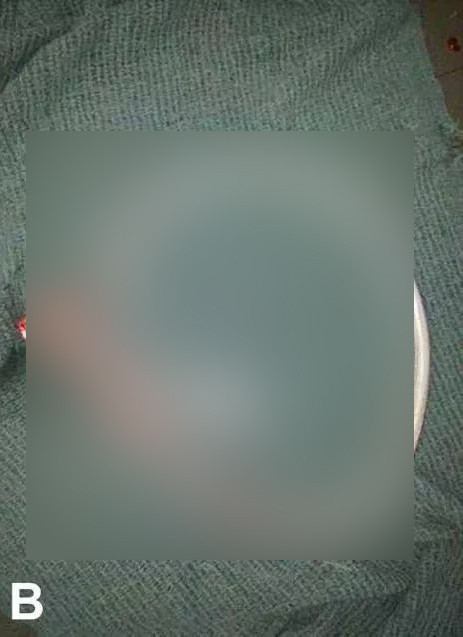 'Duşta kayıp üzerine düştüm' dedi doktorlar görünce gözlerine inanamadı - Resim: 3