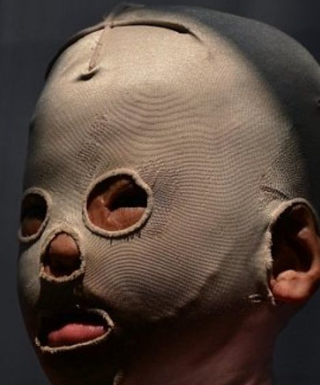 Zavallı çocuğun başına gelene bakın! - Resim: 3