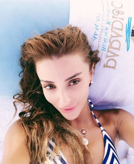 Özge Ulusoy'un estetiksiz hali ortaya çıktı hani estetik yoktu - Resim: 4