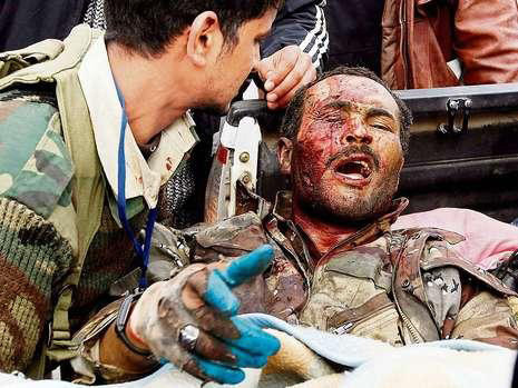 Libya'daki savaştan ürküten kareler - Resim: 4