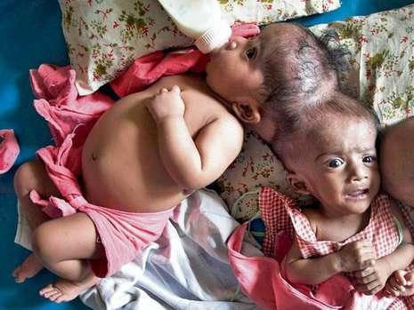 Dünyanın en tuhaf rahatsızlıkları - Resim: 3