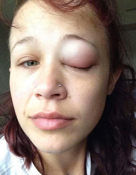 Gözü bir anda bu hale geldi doktorlar hayrete düştü - Resim: 2