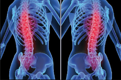 Çağın hastalığı olan bel ve boyun ağrıları için yapılması gerekenler - Resim: 3