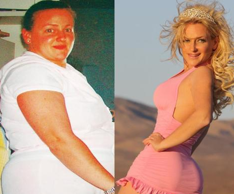 107 kilodan 48'e böyle düştü - Resim: 1