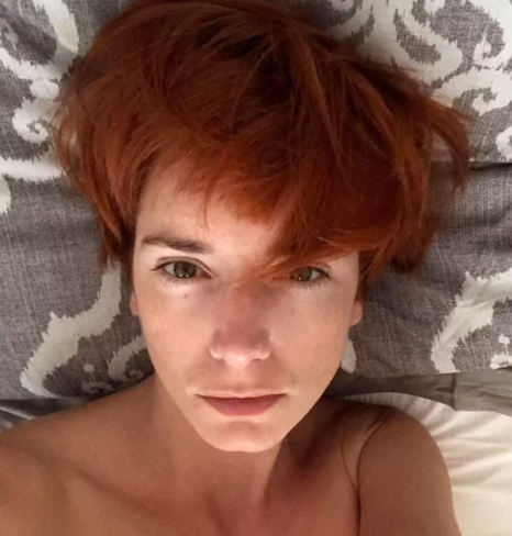 'Korkunç hissediyorum' demişti! AstraZeneca'nın aşısını olan İngiliz model öldü - Resim: 3