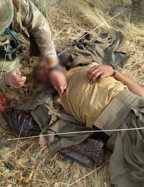 Asker PKK'lı yaralı bulunca bakın ne yaptı? - Resim: 3