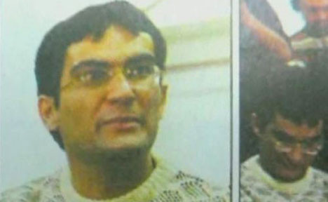 Yüzüne kezzap atıldı - Resim: 3