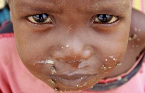 Açlıktan ölen insanların kampı Dadaab - Resim: 1