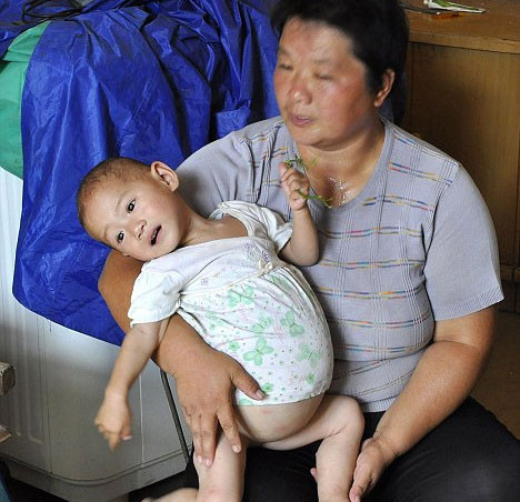 Bebeğin içinden bebek çıktı - Resim: 2