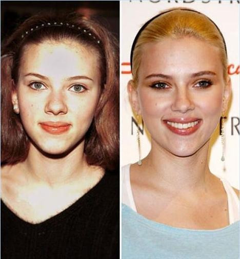 Bir burun ne kadar değiştirir ki... Estetik öncesi ve sonrası - Resim: 3