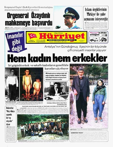 Antalya'da sıradışı kardeşler! Onlar hem kadın hem erkek - Resim: 4