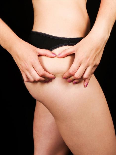 Selülitle savaşan 20 yiyecek  - Resim: 2