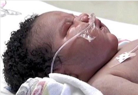 7 kilo 300 gram ağırlığında doğdu - Resim: 2