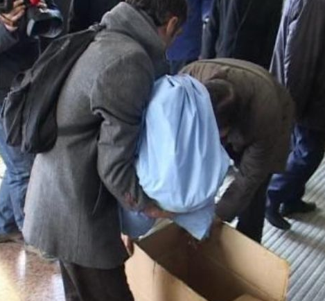 Türkiye'de 2. yüz nakli başladı! - Resim: 4