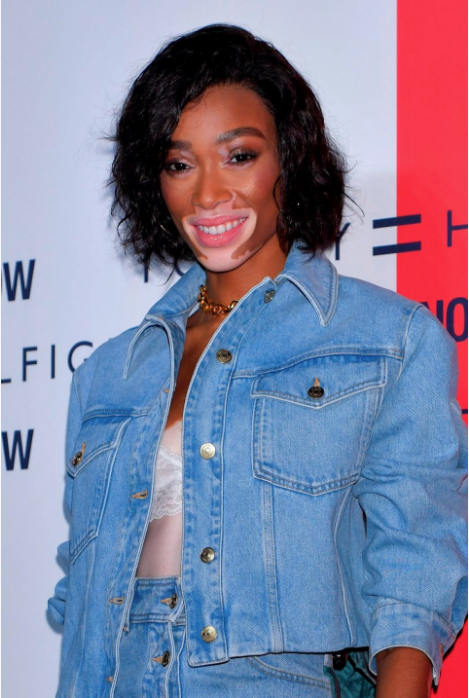 Vitiligolu melek Winnie Harlow rapçi Wiz Khalifa ile aşk yaşıyor! - Resim: 1