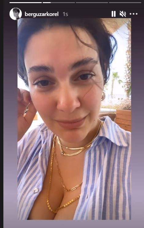Bergüzar Korel takipçilerinden rica etti: Lütfen bana bunu yapmayın! - Resim: 2