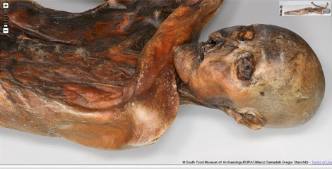 Cesedin her ayrıntısı internette - Resim: 2