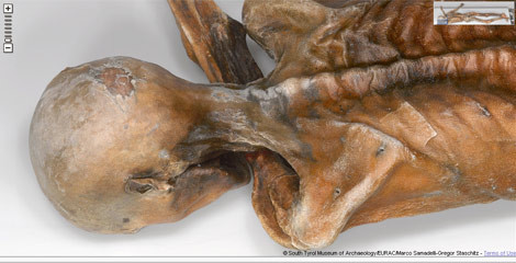 Cesedin her ayrıntısı internette - Resim: 4